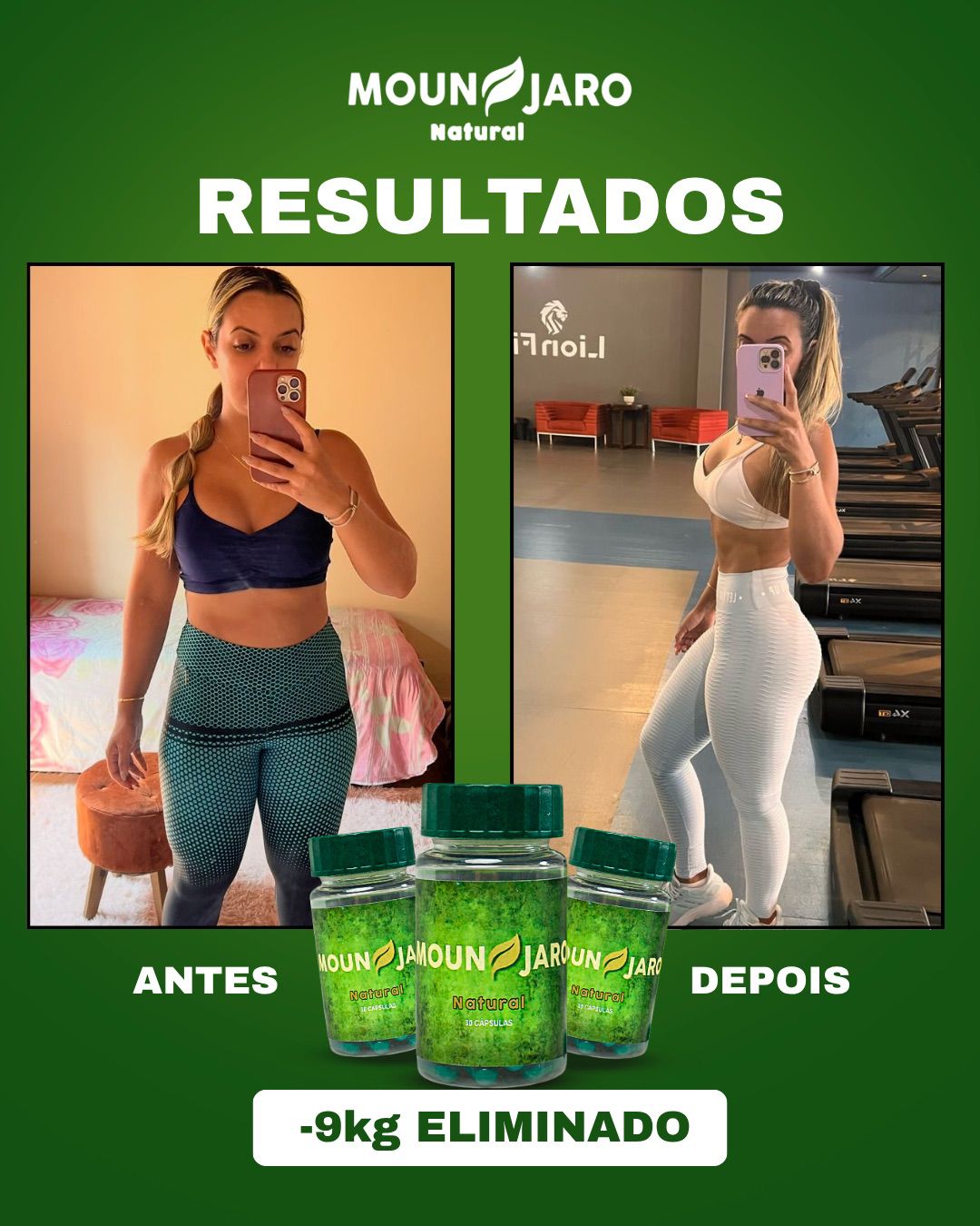 Antes e depois — resultado de 9kg eliminados