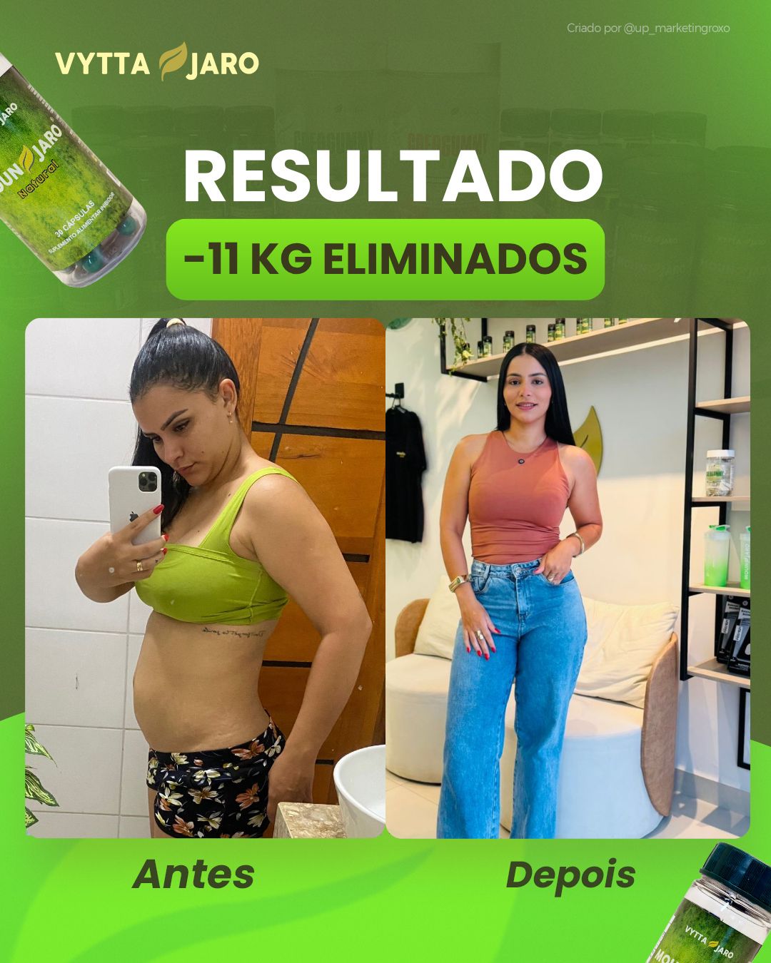 Antes e depois — resultado de 11kg eliminados